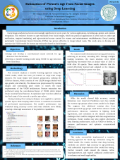 Poster Estimation of Person's Age from Facial Images using Deep Learning