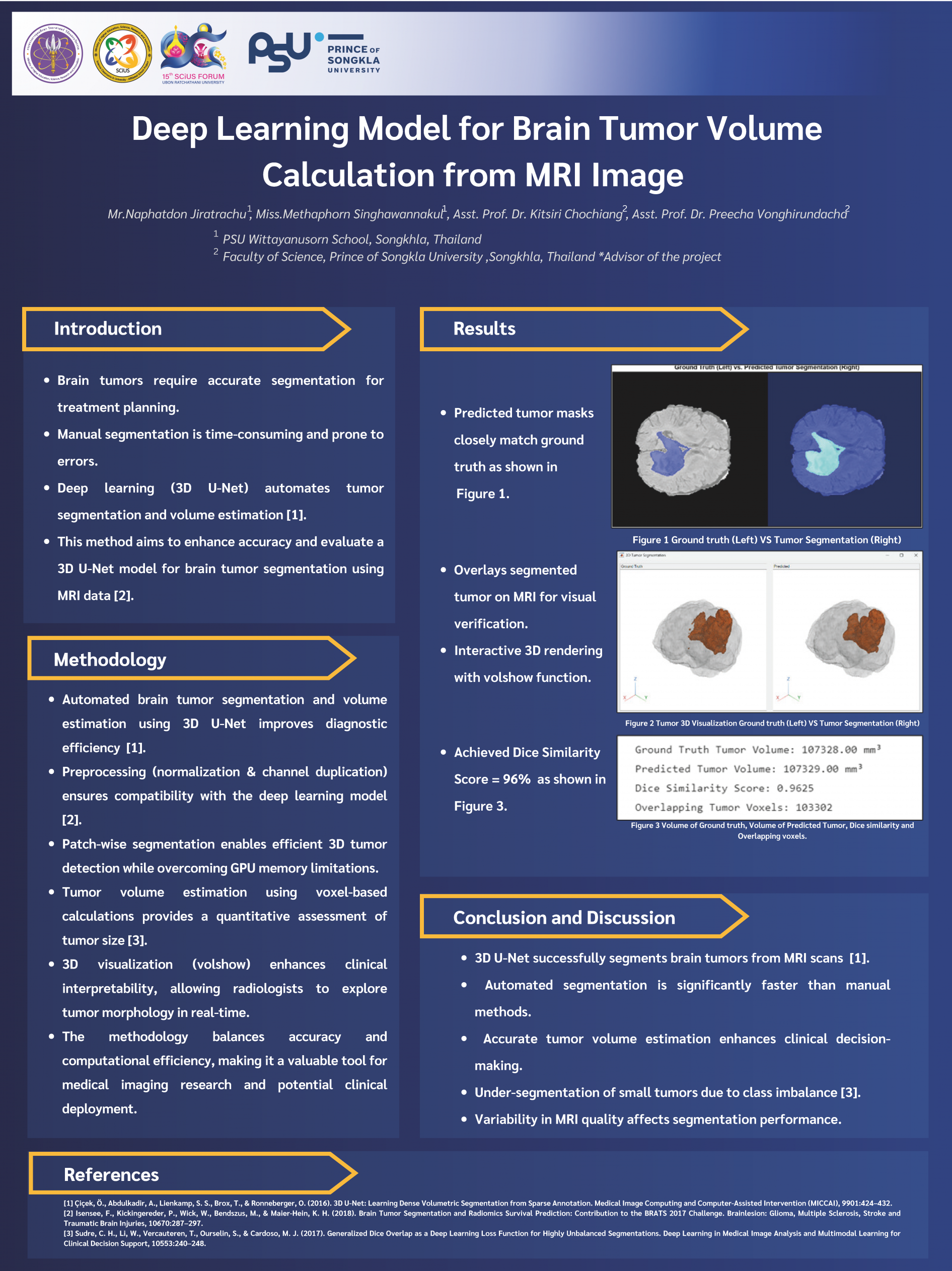 Poster Deep Learning Model for Brain Tumor Volume Calculation from MRI Image 